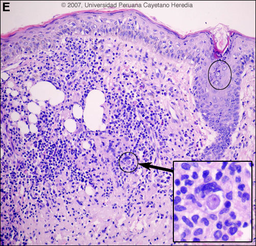 Image E for Case 2007-06