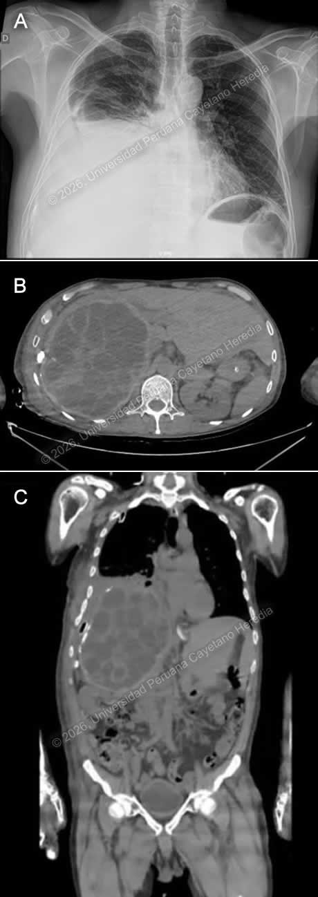 Image for Case 2026-10