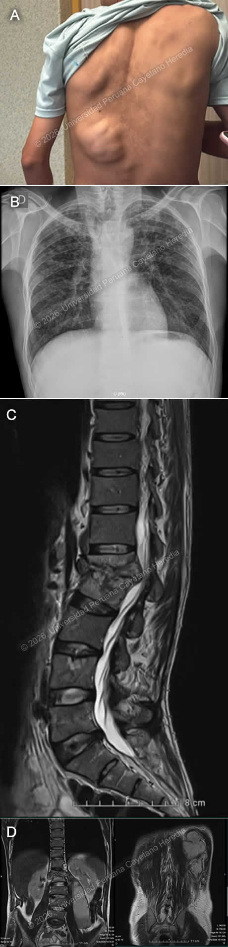 Image for Case 2026-11