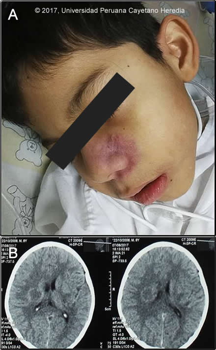 Image for Case 2017-10