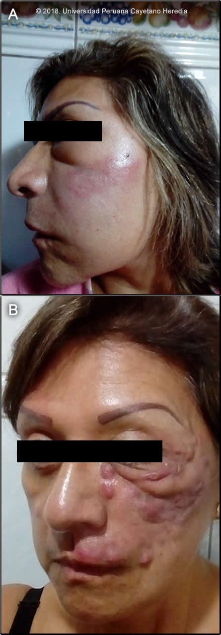 Image for Case 2018-10