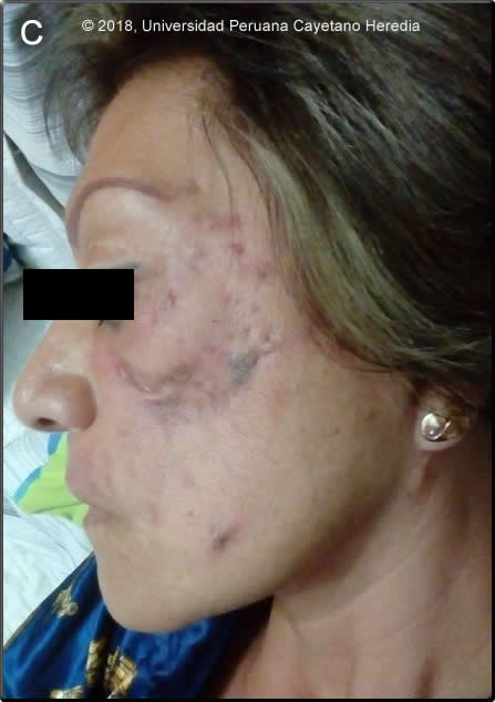 Images for Case 2018-10