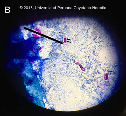 Images for Case 2018-11