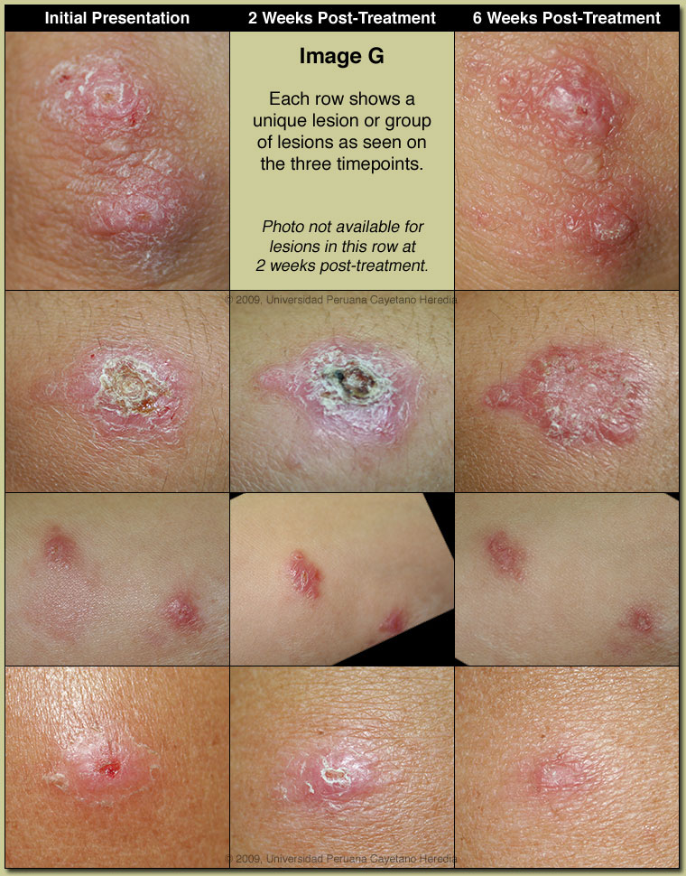 Image G for 03/02/09 Discussion