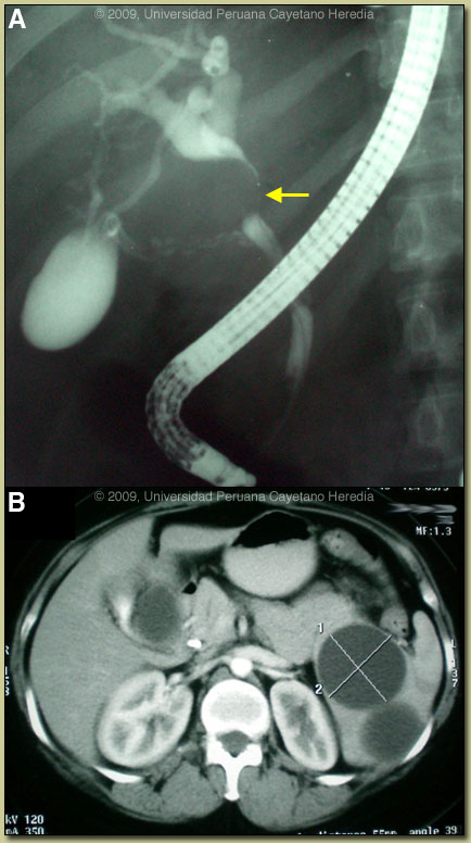 Image AB for 03/16/09