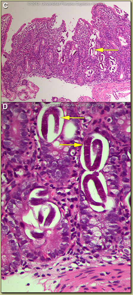 Images CD for 02/20/2012 Discussion