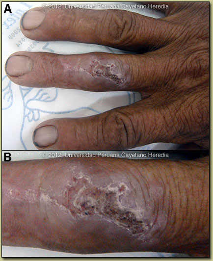 Image AB for 3/12/2012