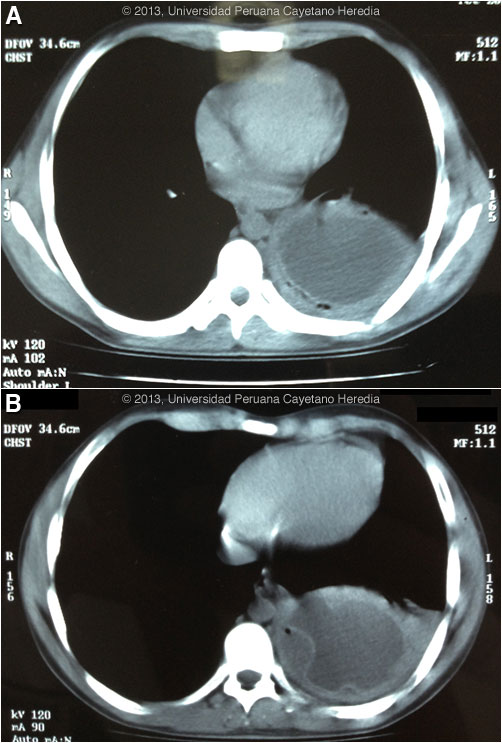Image AB for Case 2013-01