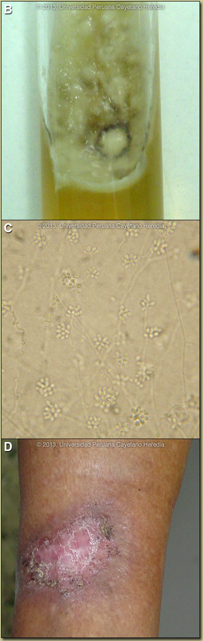 Images BCD for 02/18/2013 Discussion