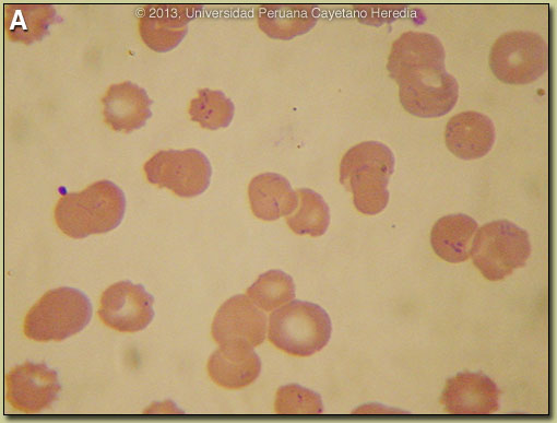 Image A for 03/11/2013