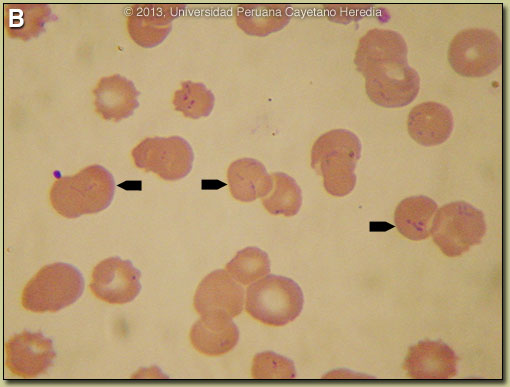 Images B for 03/11/2013 Discussion