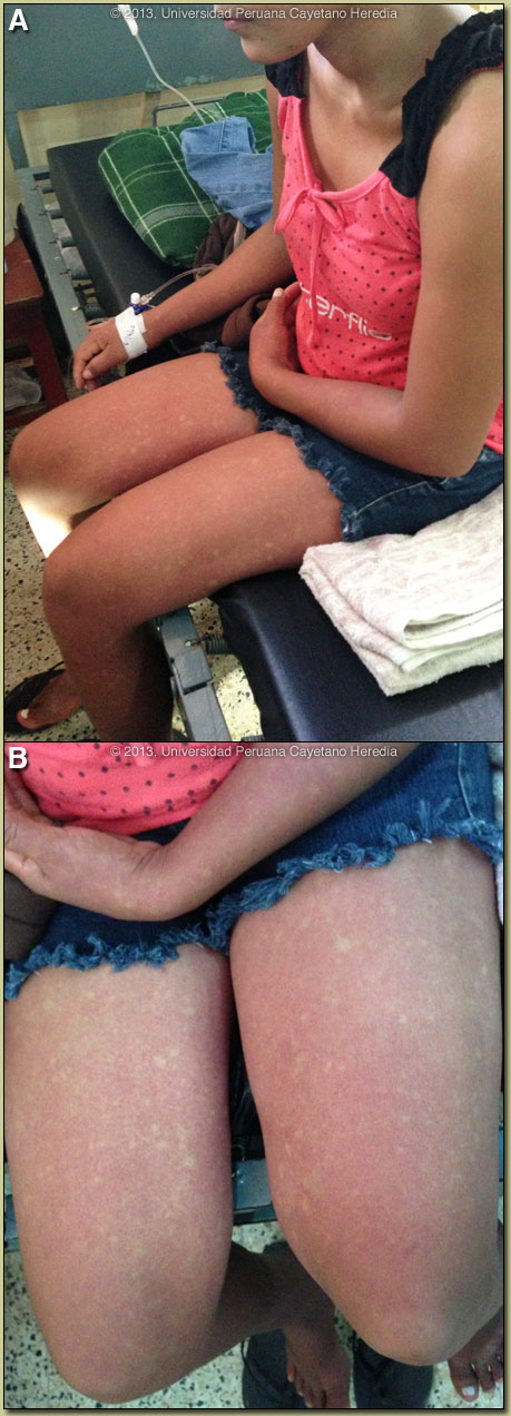 Image AB for 04/08/2013