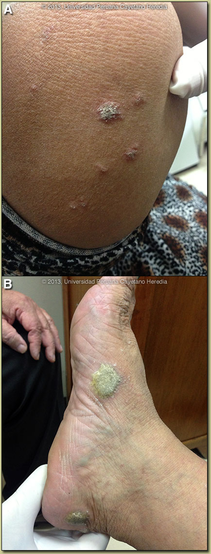 Image AB for 08/19/2013