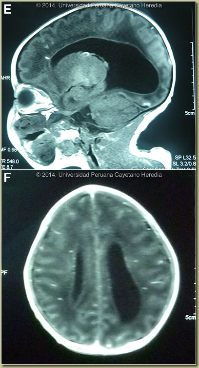 Image EF for 02/24/2014 Discussion