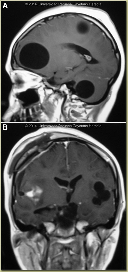 Image AB for 03/03/2014