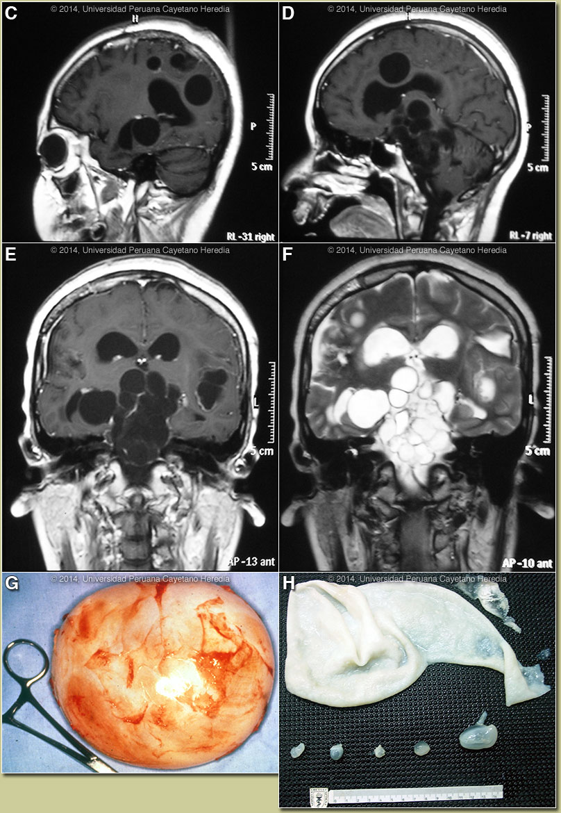 Image CDEFGH for 03/03/2014 Discussion