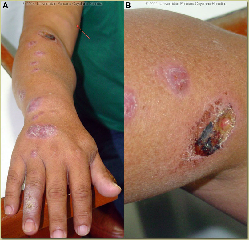 Image AB for 08/25/2014