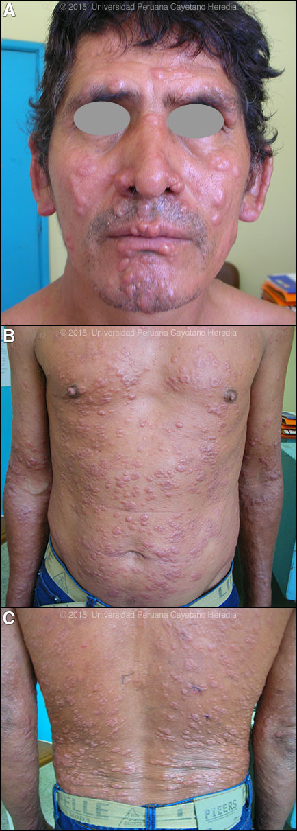 Images ABC for Case 2015-03