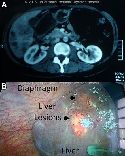Images AB for Case 2015-05