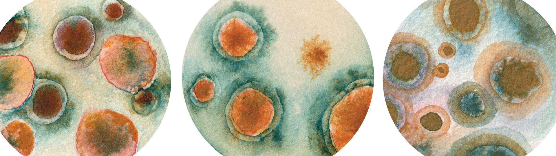 Watercolor illustrations evocative of fungus growing in petri dishes.
