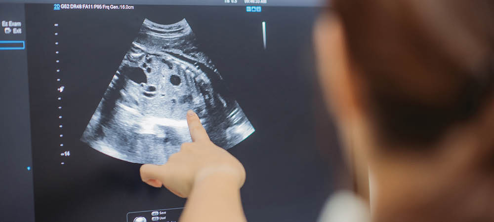 A hand points to a gestational ultrasound image on a screen.