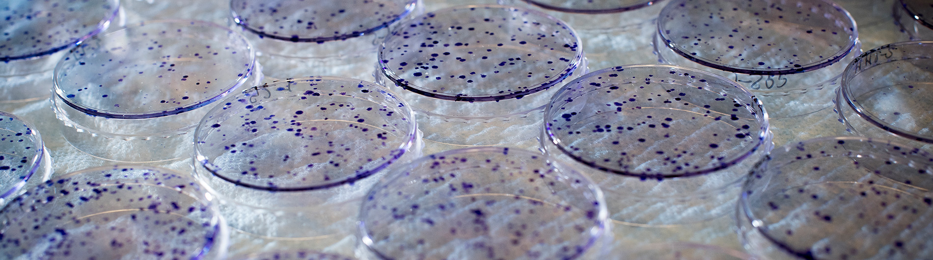 Close-up of bacteria growing on Petri dish in Eddy Yang's Laboratory inside the Hazelrig Salter Radiation Oncology Center, 2019.