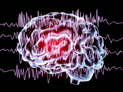 UAB begins offering LITT for epilepsy treatment