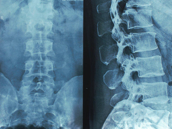 Neurosurgery relaunches spine fellowship