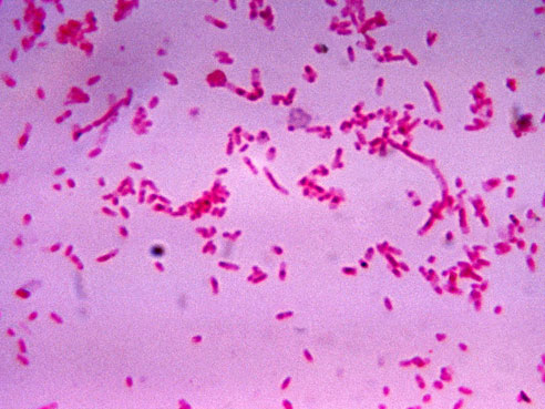 Fusobacterium novum 01