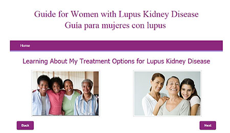 lupus disease 1