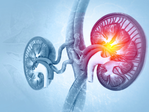 UAB researchers reveal why some transplants trigger harmful antibody responses