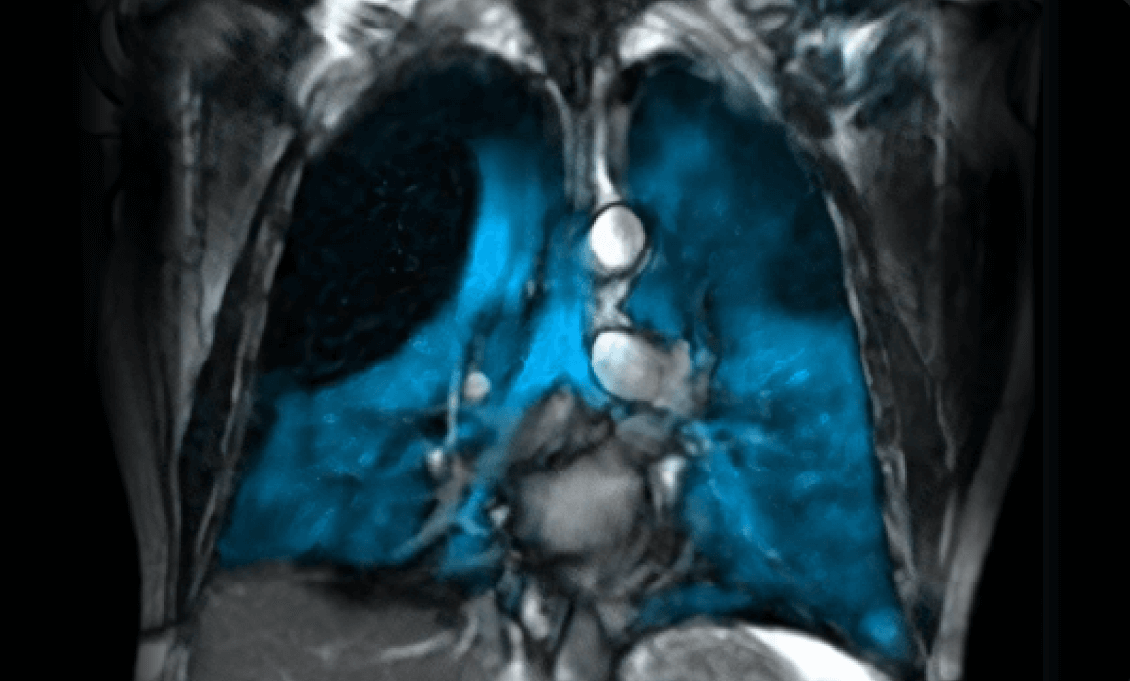 xenoview mri