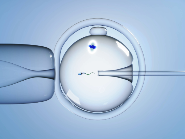 7 facts about male infertility from a UAB urologist