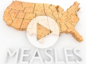 Risk of forgetting medical miracles: measles outbreak