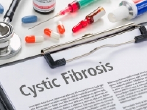 UAB clinical trials pave way to new cystic fibrosis drug