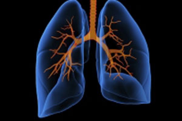 UAB named to national pulmonary fibrosis care network