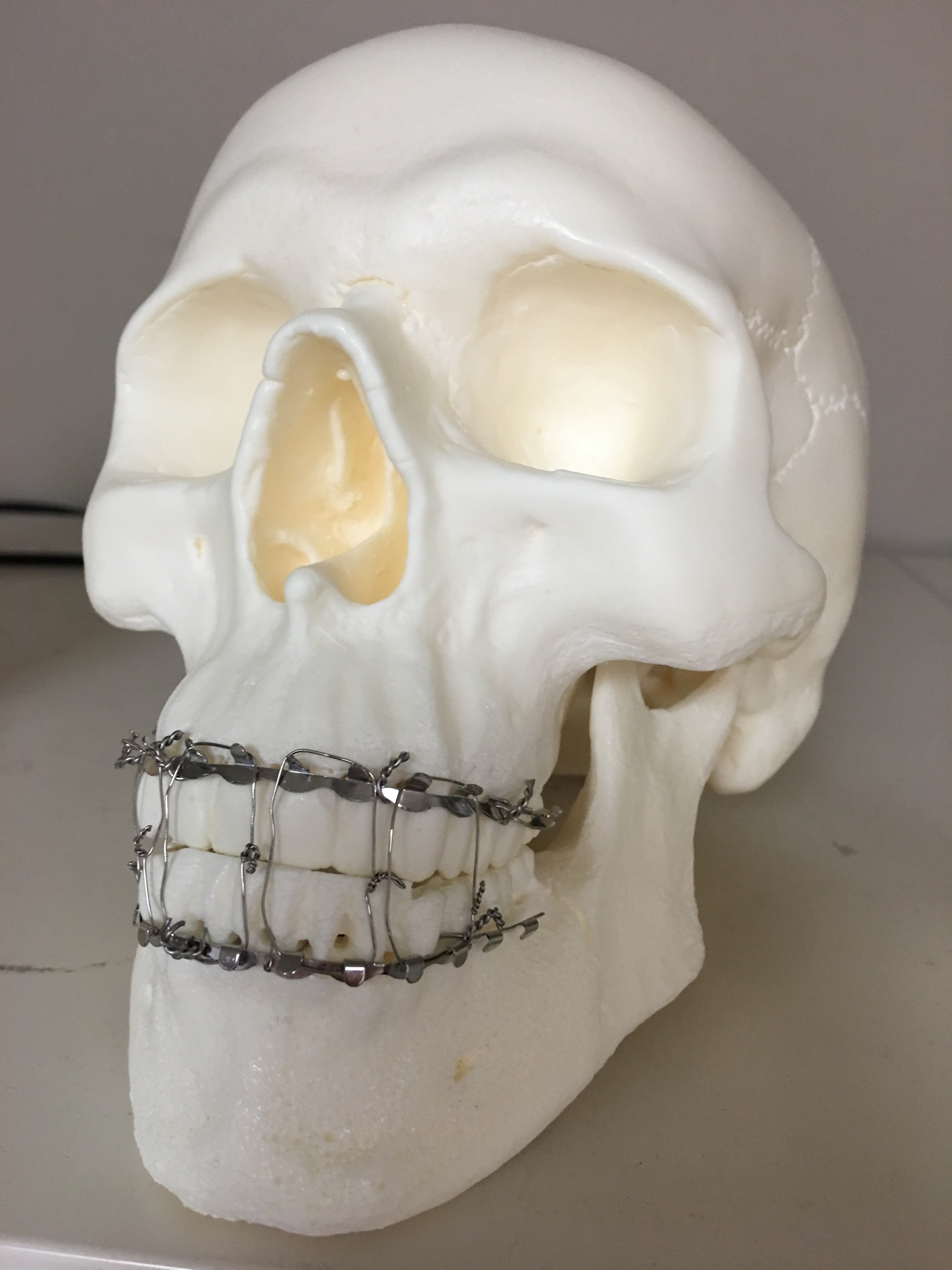 Fake skull used in UAB resident arch bar training workshop
