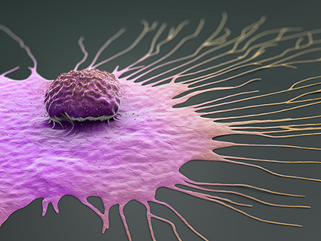 Migrating breast cancer cell, 3d illustration.