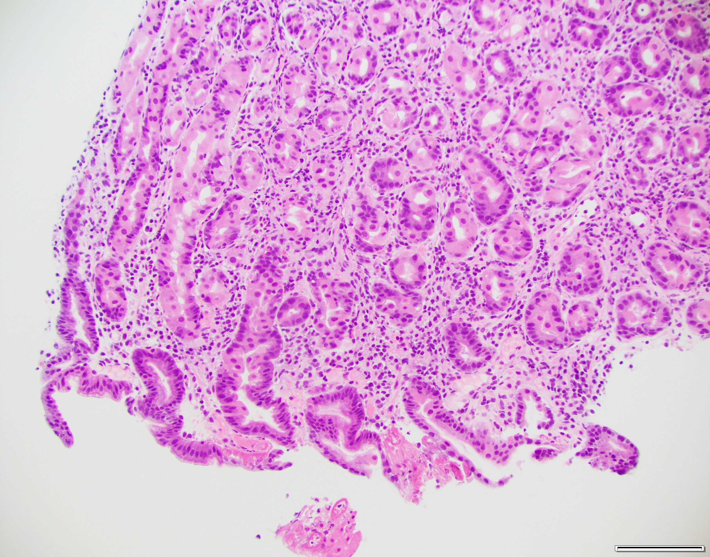 Case of the week gastric biopsy 1