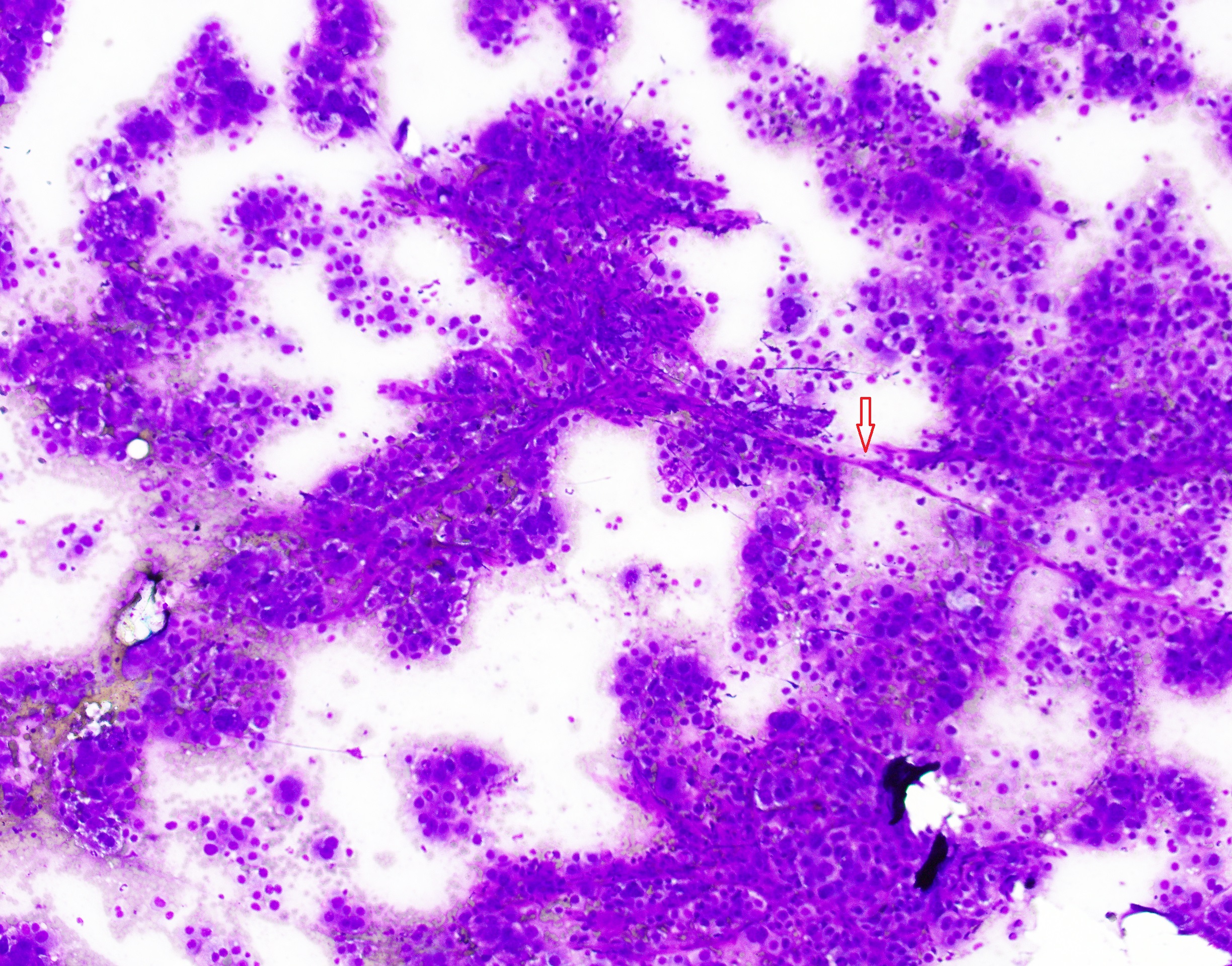 2020-11-20T19:26:17Z