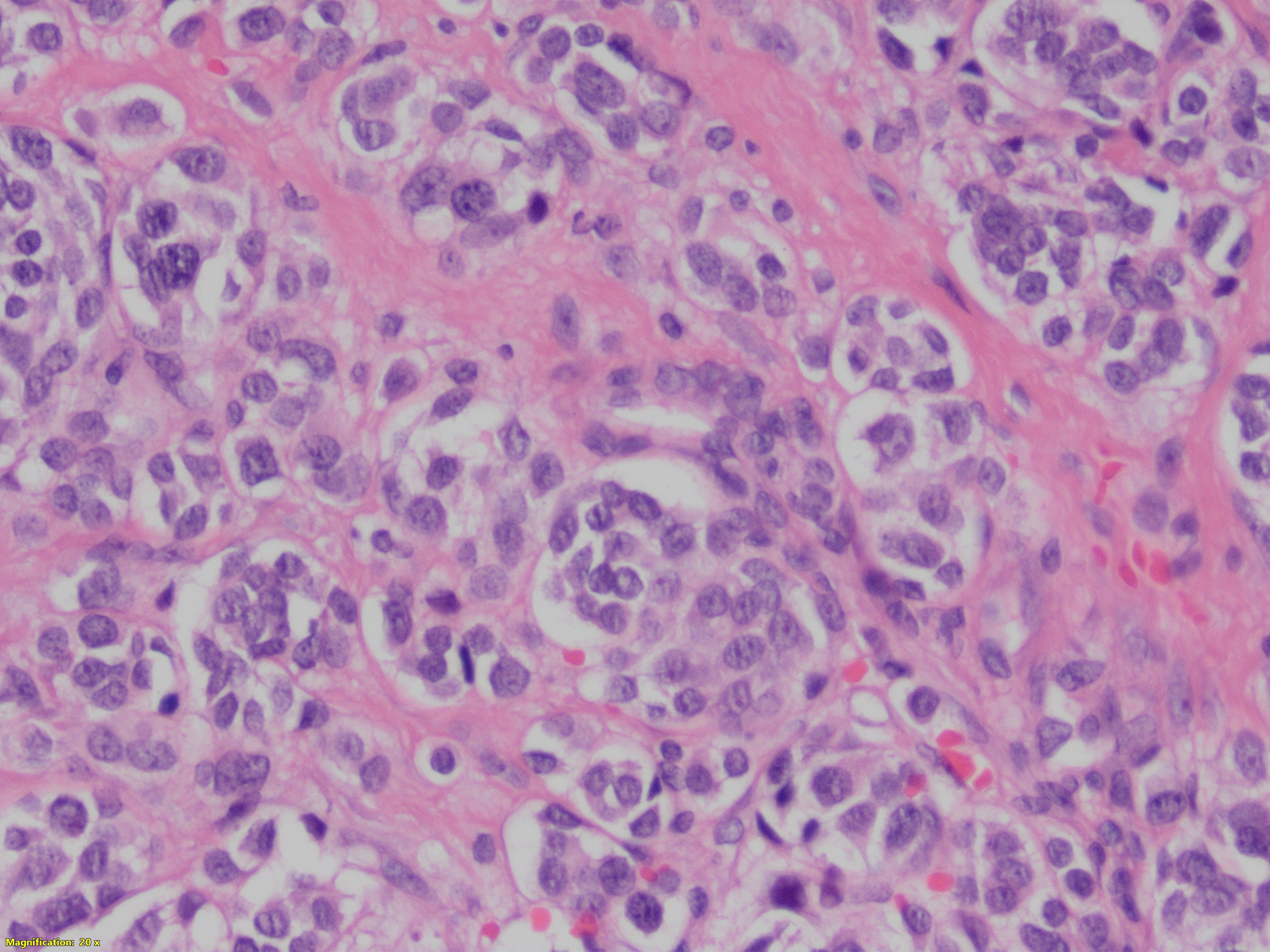 cyto 5