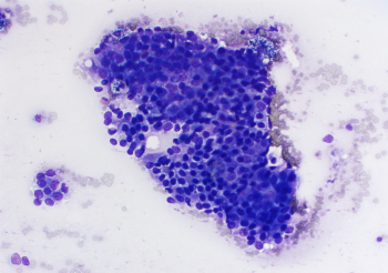 Rosenblum 6.20.22 Case2.1