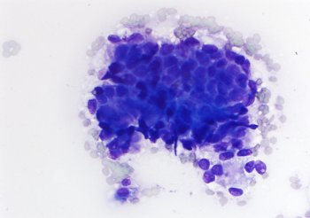 Rosenblum 6.20.22 Case3.1