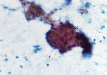 Rosenblum 6.20.22 Case4.1