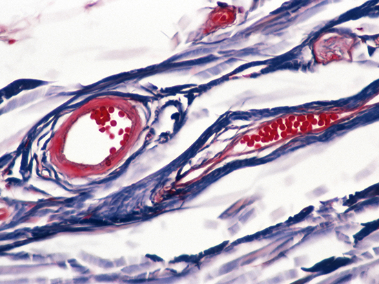 BLOOD VESSELS. SKIN; SUBCUTANEOUS LAYER, VENULES (RIGHT), ARTERIOLE (LEFT), RED BLOOD CELLS. 100X