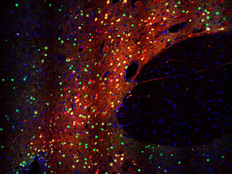 Newswise: Robust and specific gene regulation tool developed for primary brain neurons