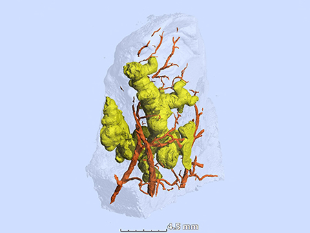 3-D image of granulomas and blood vessels