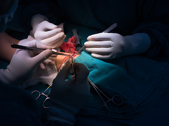 Vascular surgeon and team perform arteriovenous fistula