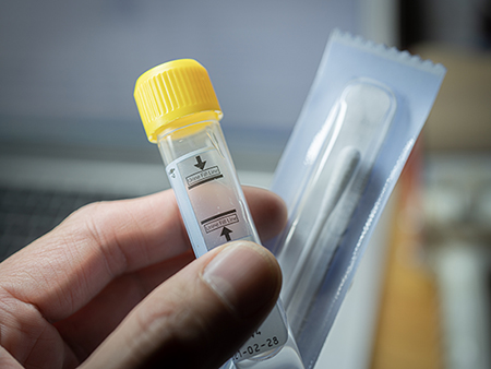 A sample collection tube for PCR (polymerase chain reaction) testing which is commonly used in the laboratory to screen patients for chlamydia and gonorrhoea infections.