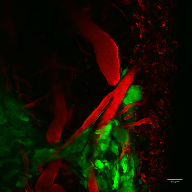 Glioma cells on vasculature